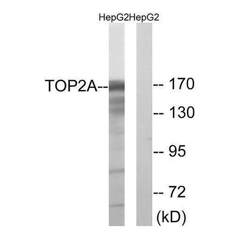 Merck Anti-TOP2A antibody produced in rabbit
