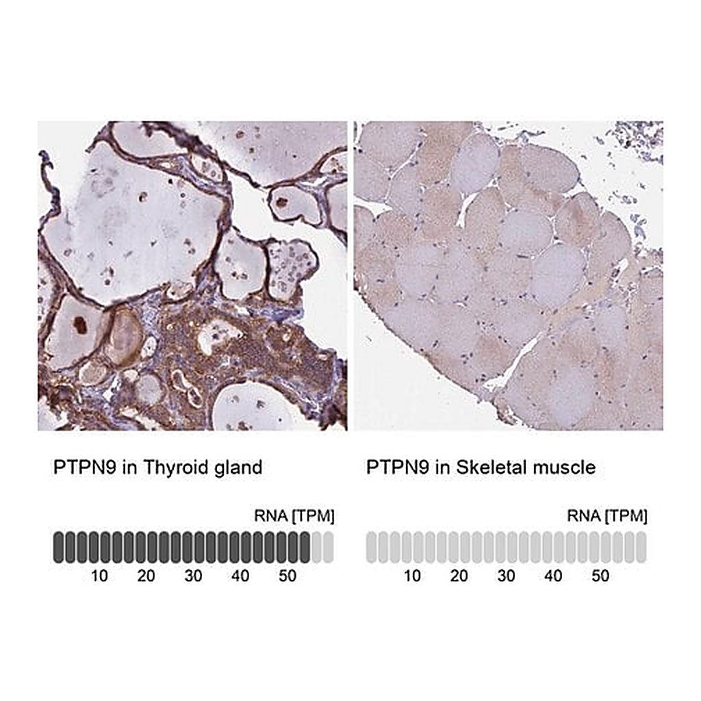 Merck Anti-PTPN9 antibody produced in rabbit