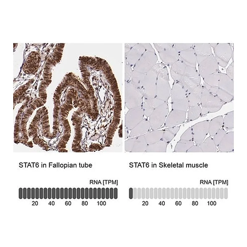 Merck Anti-STAT6 antibody produced in rabbit