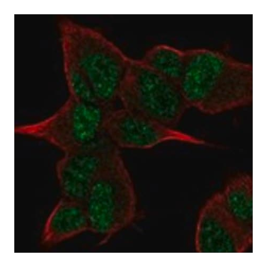 Merck Anti-ANGEL2 antibody produced in rabbit
