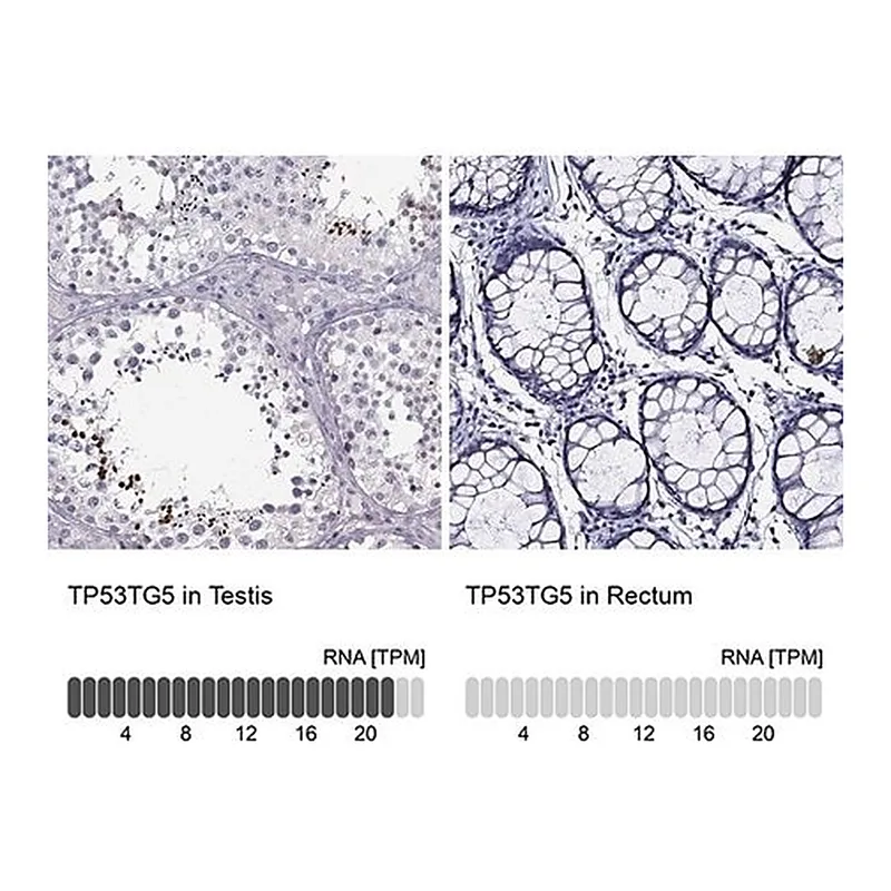 Merck Anti-TP53TG5 antibody produced in rabbit