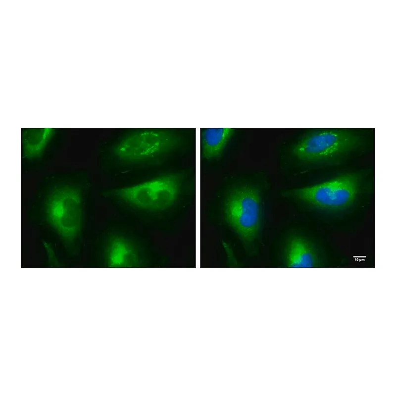 Merck Monoclonal Anti-mTOR antibody produced in mouse
