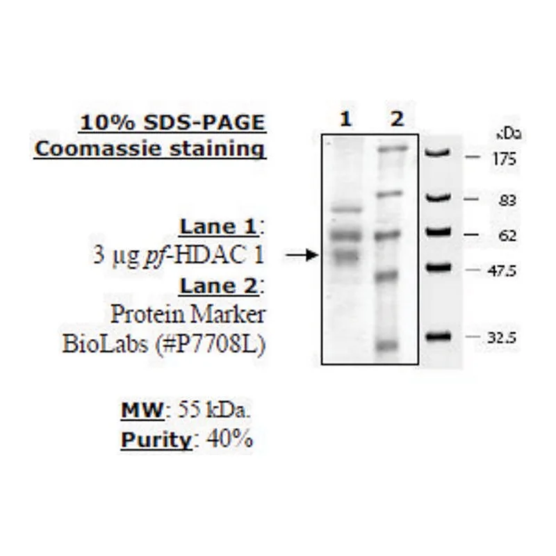 Merck HDAC 1 from Plasmodium falciparum