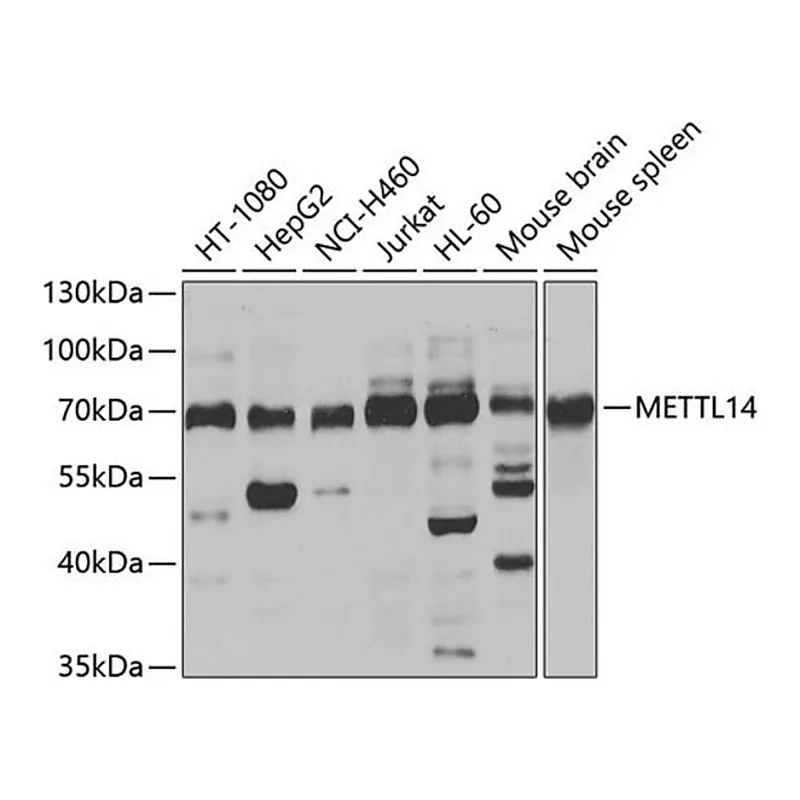 Merck Anti-METTL14 antibody produced in rabbit
