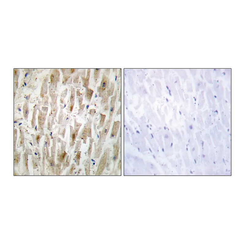 Merck Anti-LIMK2 antibody produced in rabbit