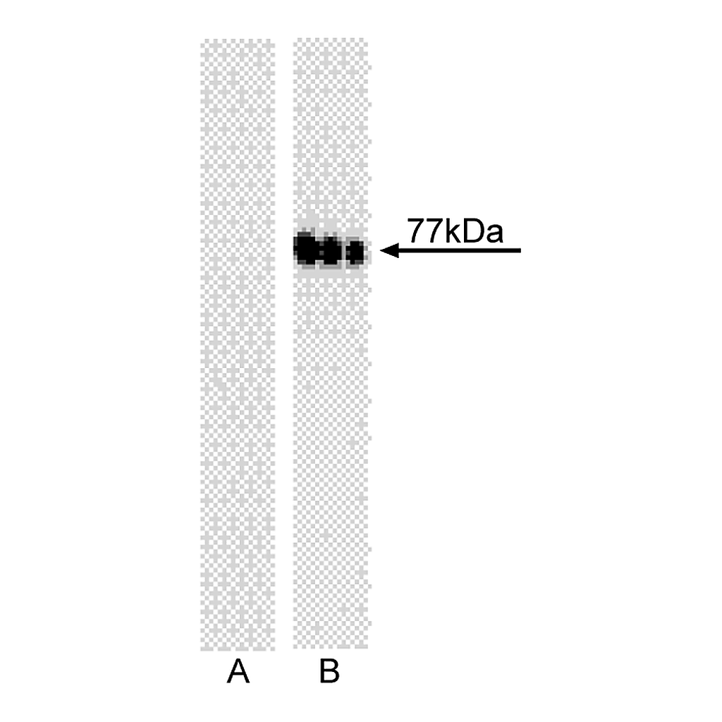 BD Purified Mouse anti-Btk (pY551)/Itk (pY511)
