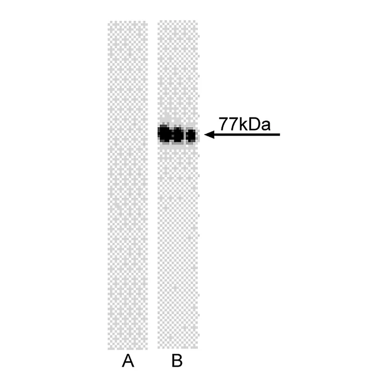 BD Purified Mouse anti-Btk (pY551)/Itk (pY511)