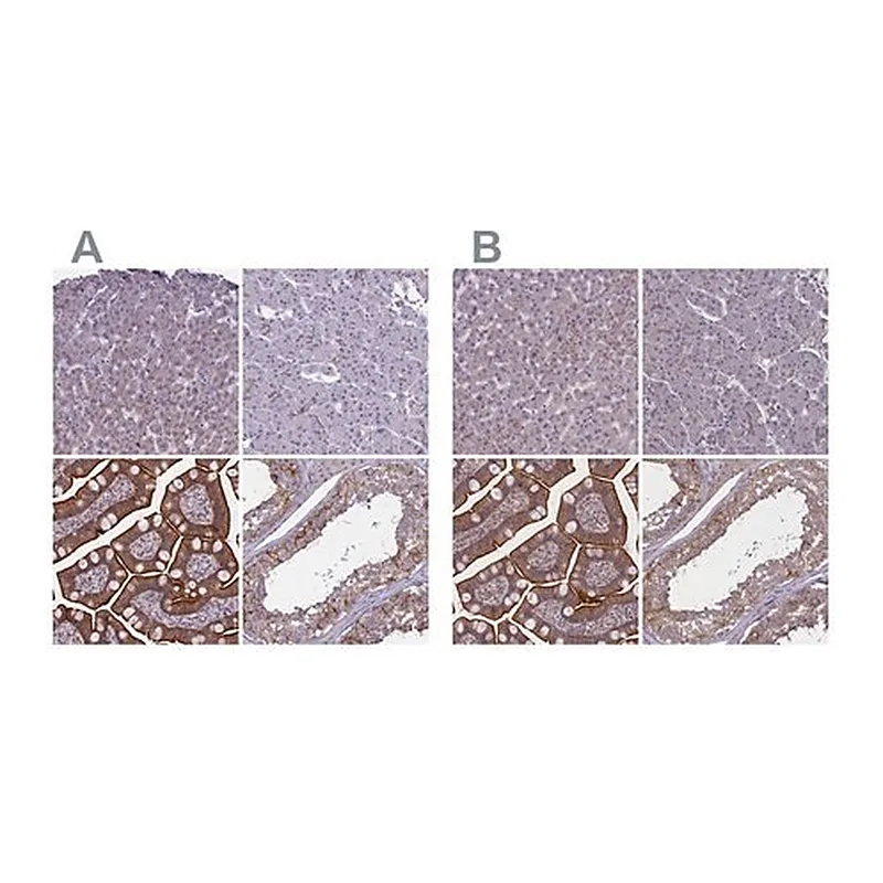 Merck Anti-CORO2A antibody produced in rabbit