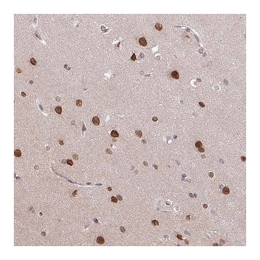 Merck Anti-RBM4 antibody produced in rabbit