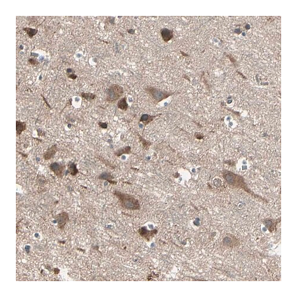 Merck Anti-PNPLA7 antibody produced in rabbit