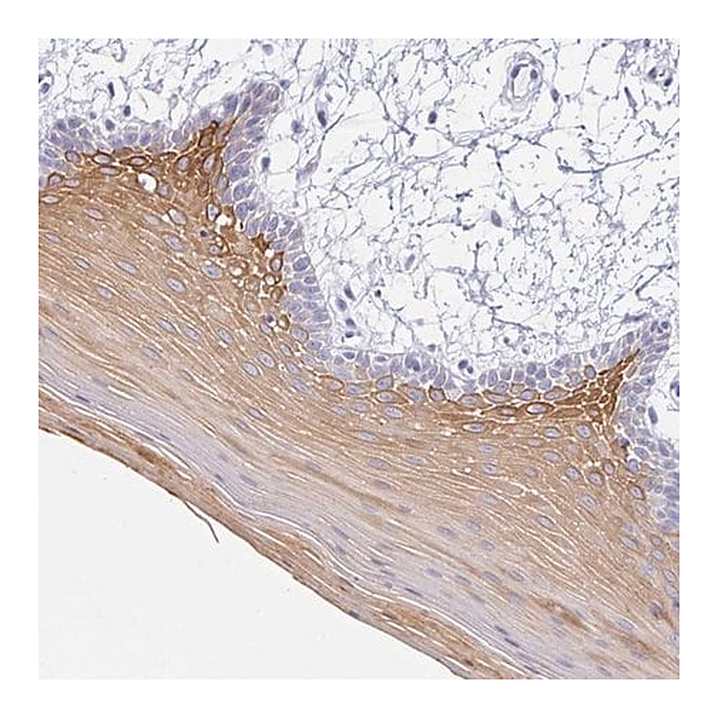 Merck Anti-KRT4 antibody produced in rabbit