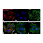 Thermo Fisher Scientific F(ab`)2-Goat anti-Rabbit IgG (H+L) Secondary Antibody, Qdot 655
