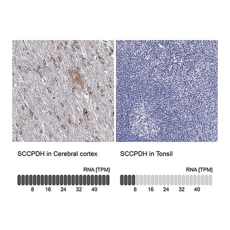 Merck Anti-SCCPDH antibody produced in rabbit