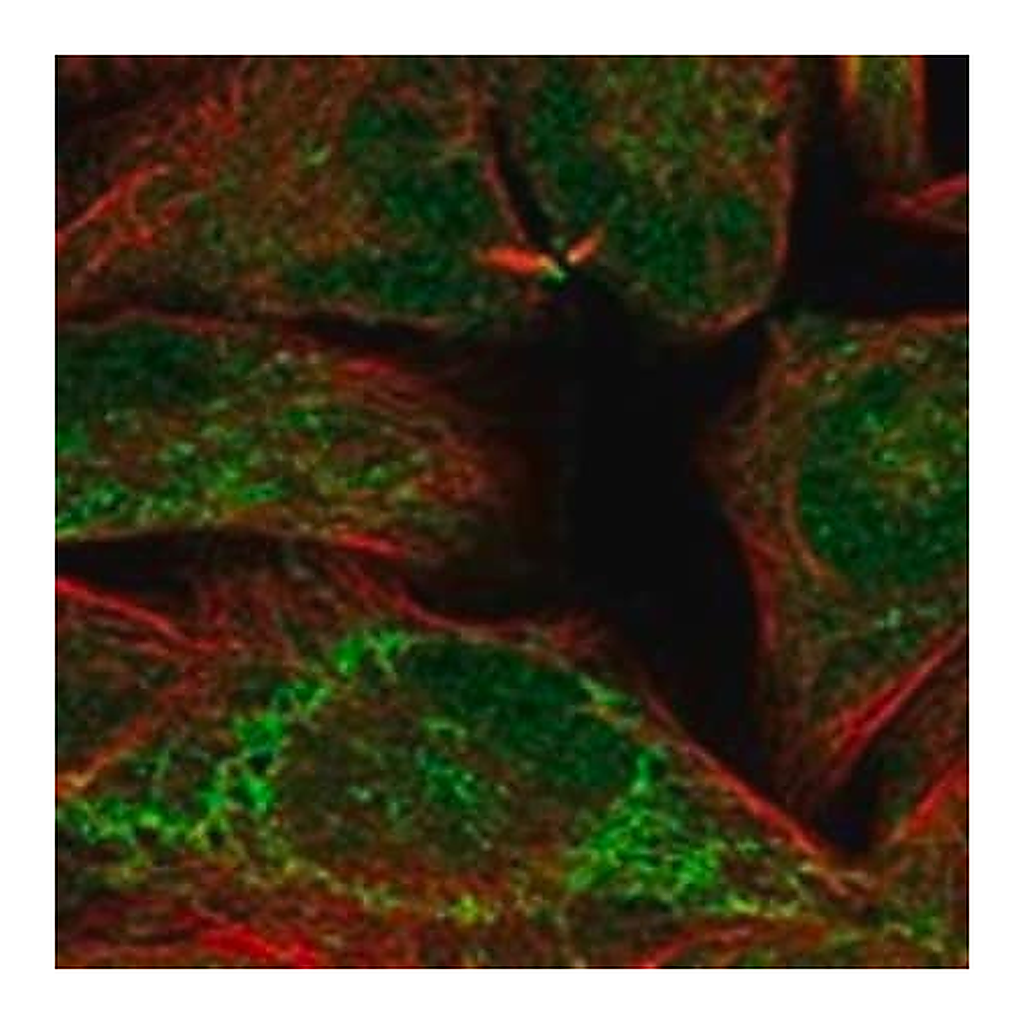 Merck Anti-IGSF22 antibody produced in rabbit