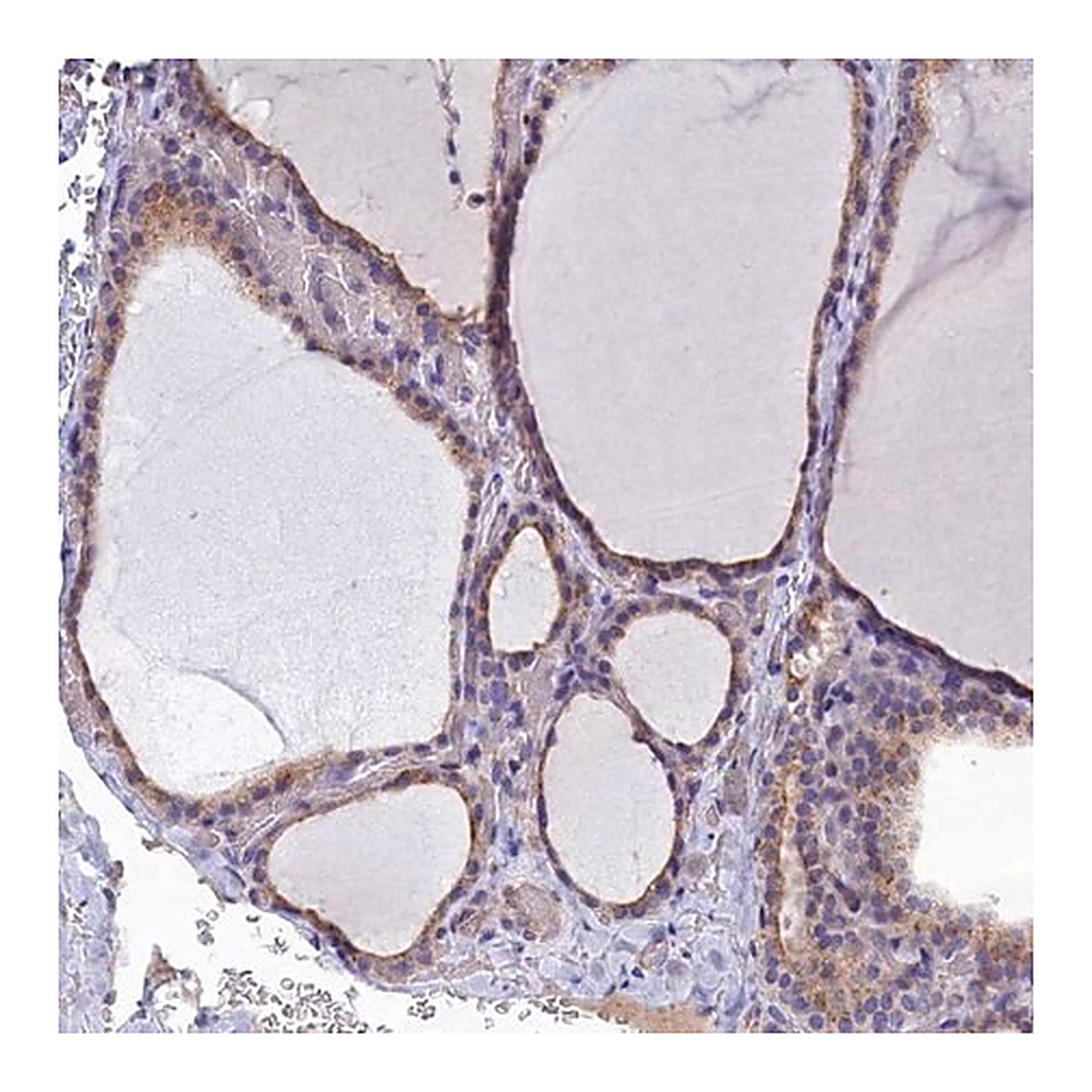 Merck Anti-RABGAP1 antibody produced in rabbit