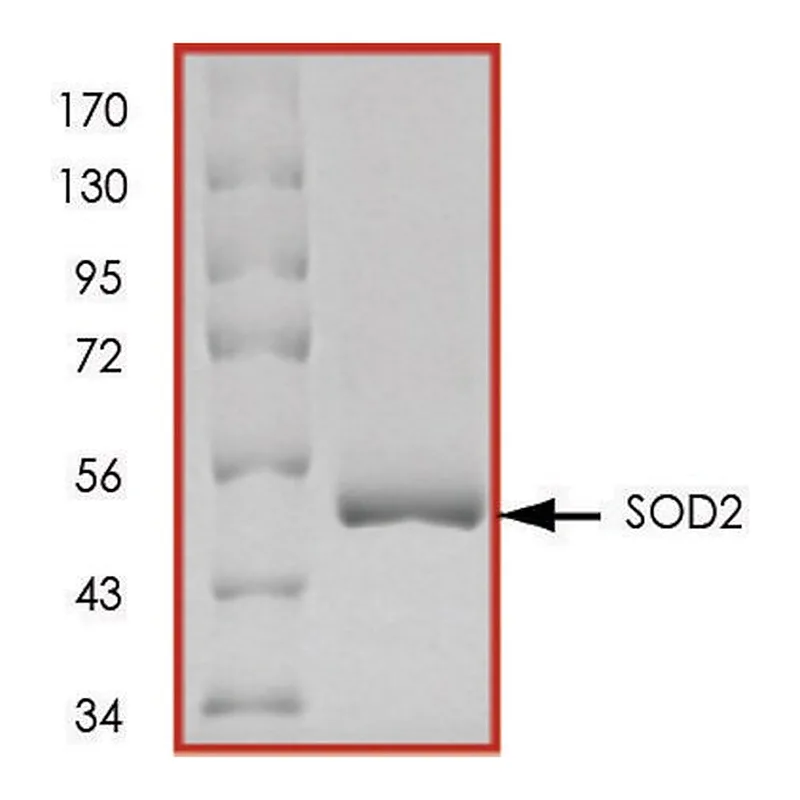 Merck SOD2, GST tagged human