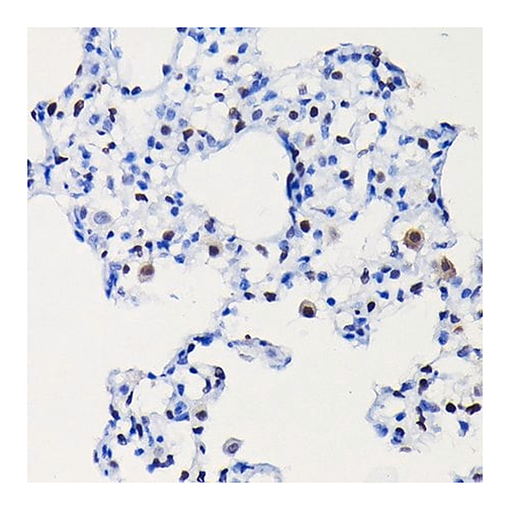 Merck Anti- Cyclin D1 antibody produced in rabbit