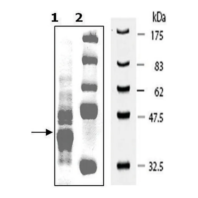 Merck PKLR Var1 active human