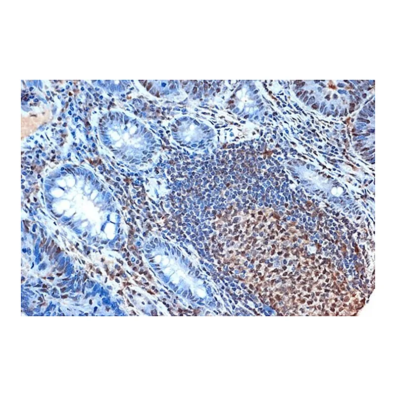 Merck Anti-FEN-1 antibody produced in rabbit