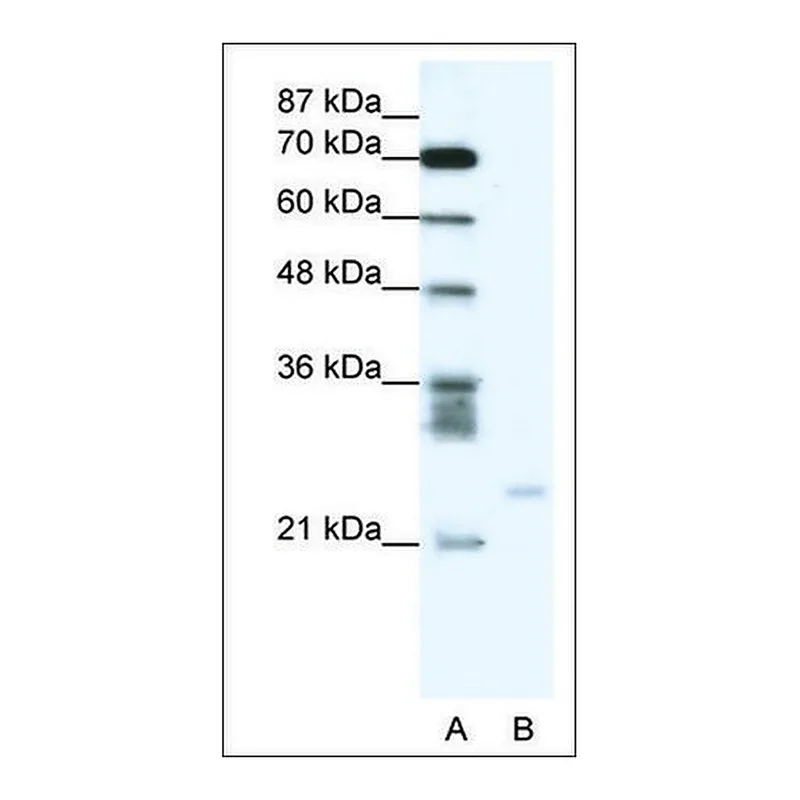 Merck Anti-BCL2A1 antibody produced in rabbit