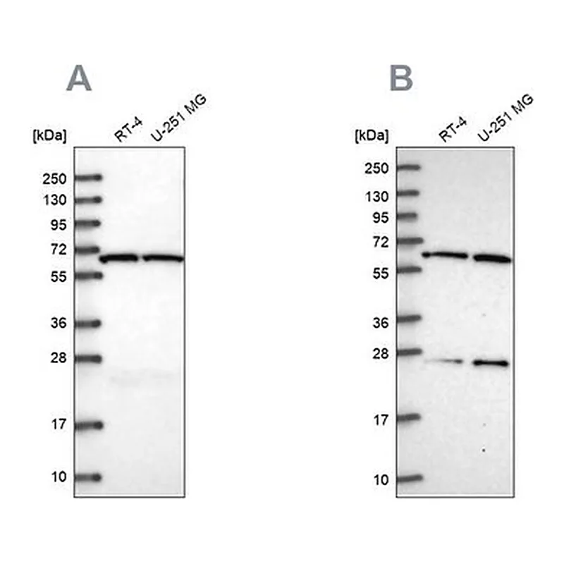 Merck Anti-ACAD9 antibody produced in rabbit