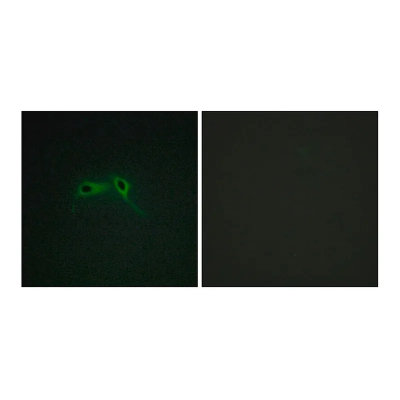 Merck Anti-NF1 antibody produced in rabbit
