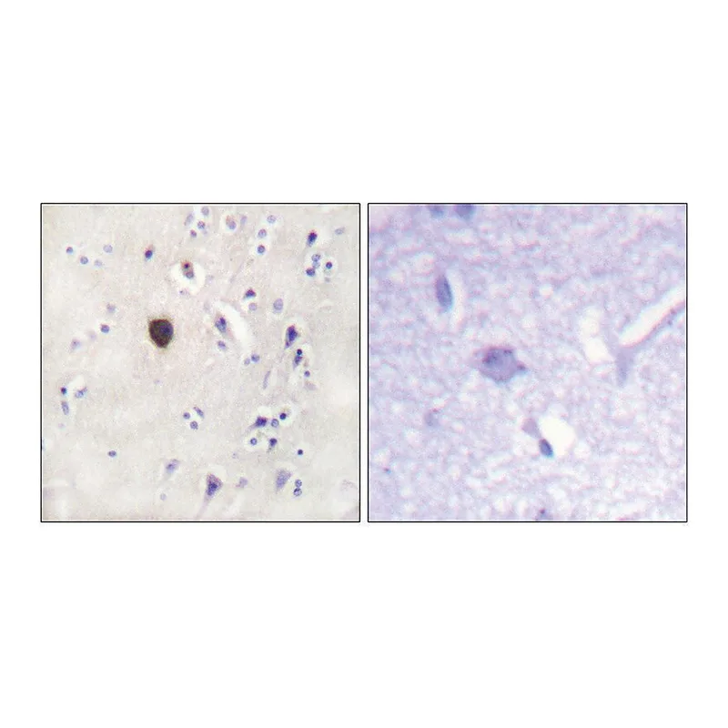 Merck Anti-KIR6.2 antibody produced in rabbit