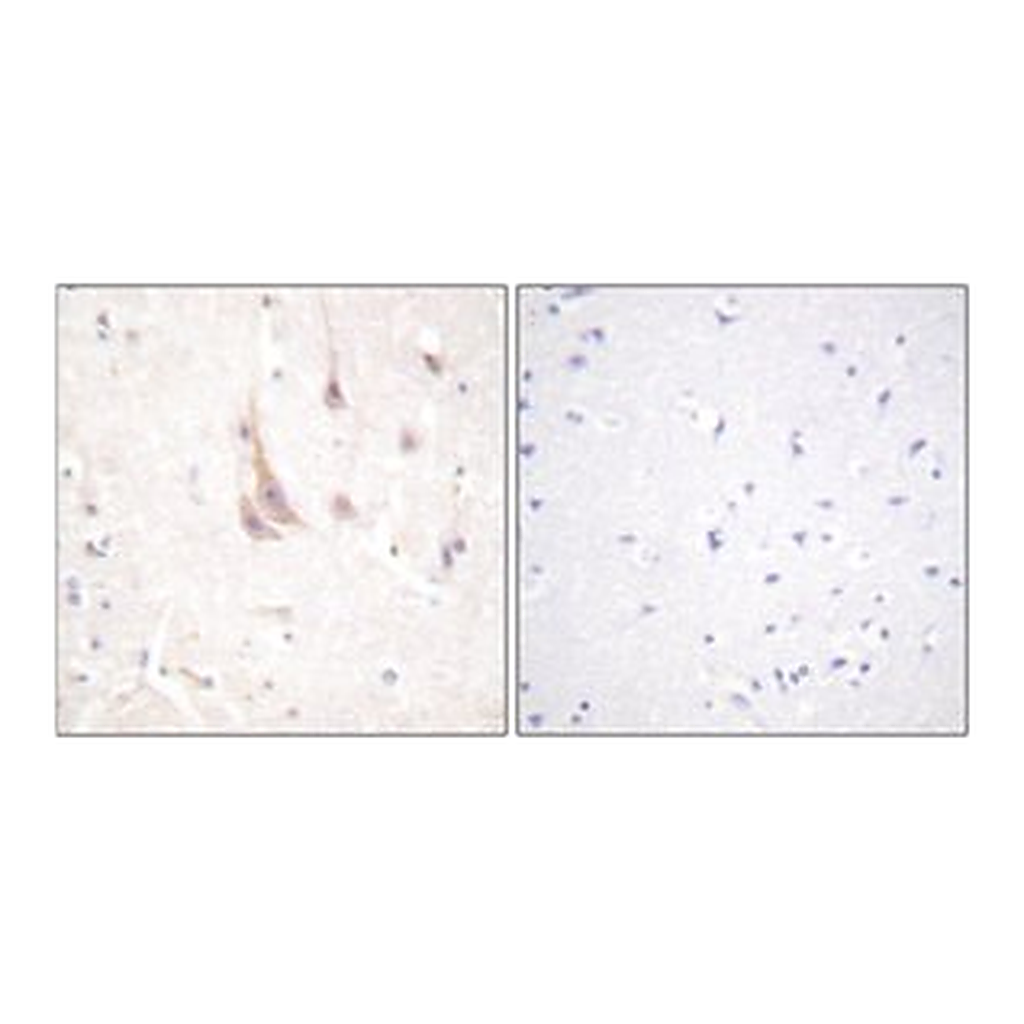 Merck ANTI-PKC ? ANTIBODY PRODUCED IN RABBIT