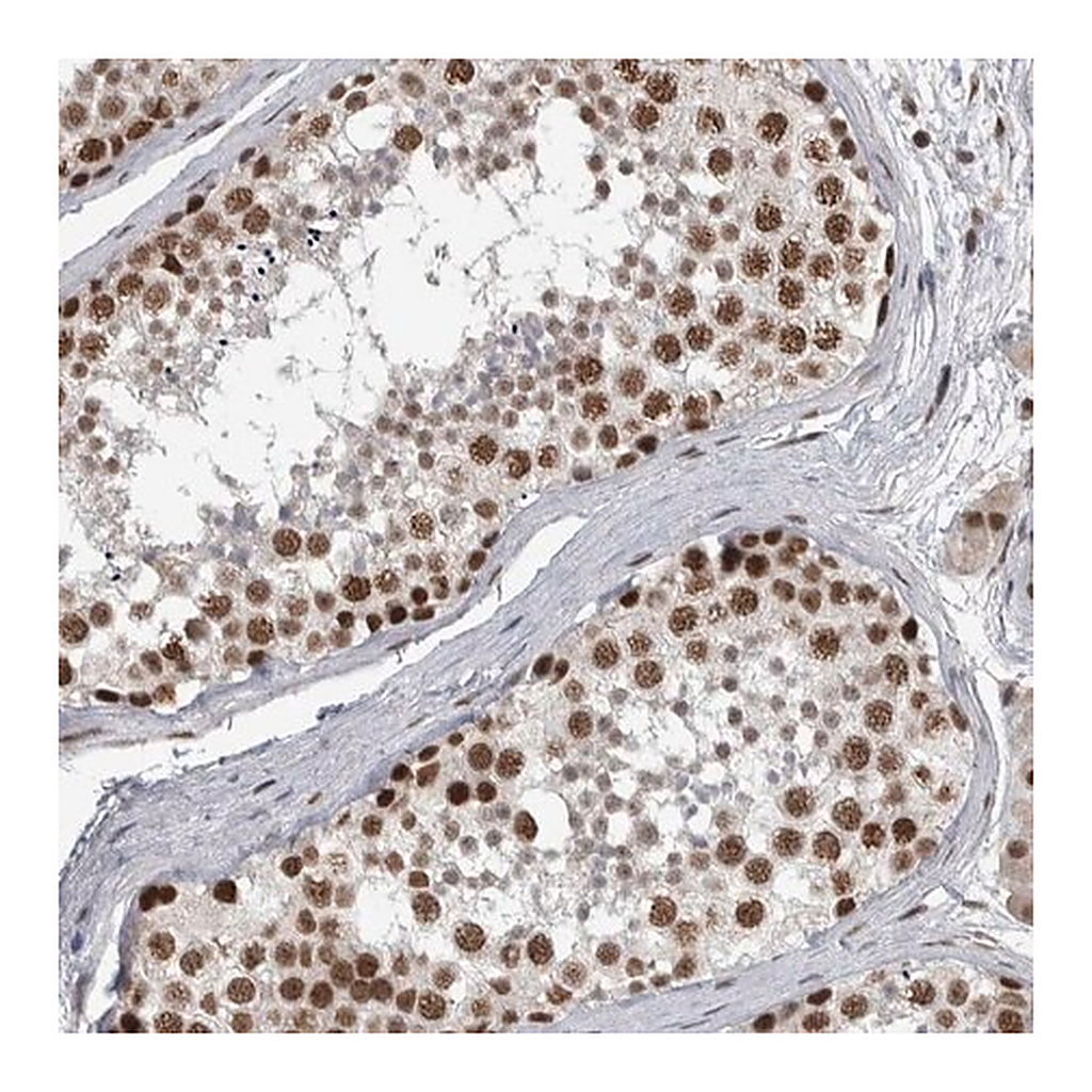 Merck Anti-DDX42 antibody produced in rabbit
