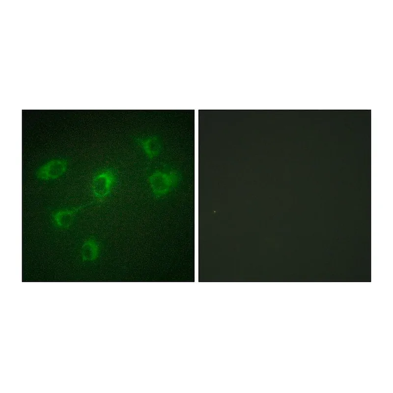 Merck Anti-TGF beta Receptor III antibody produced in rabbit