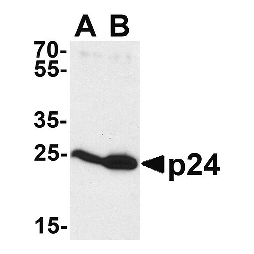 Merck Anti-HIV-1 p24 antibody produced in rabbit