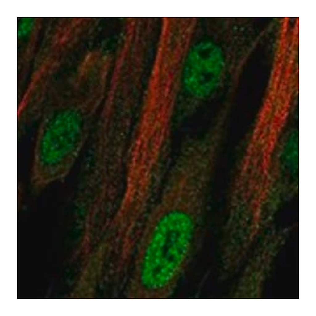 Merck Anti-TSHZ3 antibody produced in rabbit