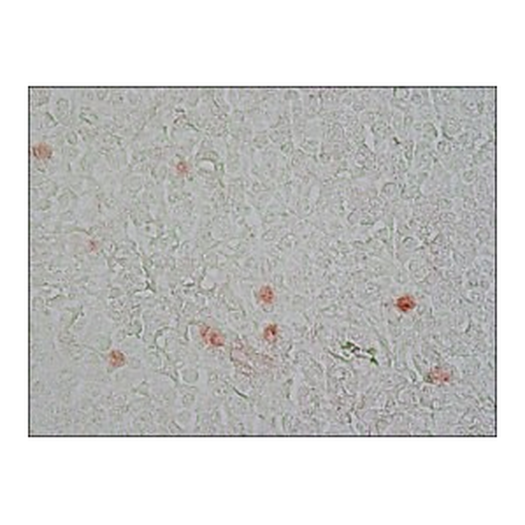 Merck MONOCLONAL ANTI-PROLIFERATING PROTEIN K&