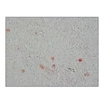 Merck MONOCLONAL ANTI-PROLIFERATING PROTEIN K&