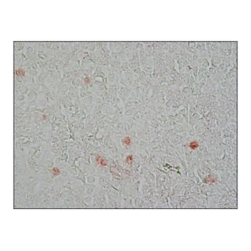 Merck MONOCLONAL ANTI-PROLIFERATING PROTEIN K&