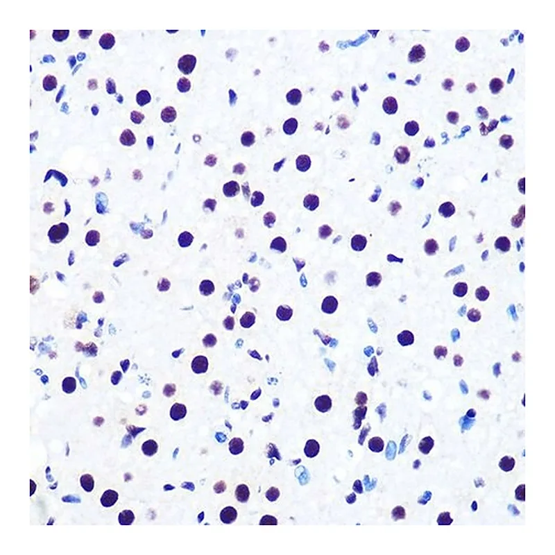 Merck Anti-DDX5 antibody produced in rabbit