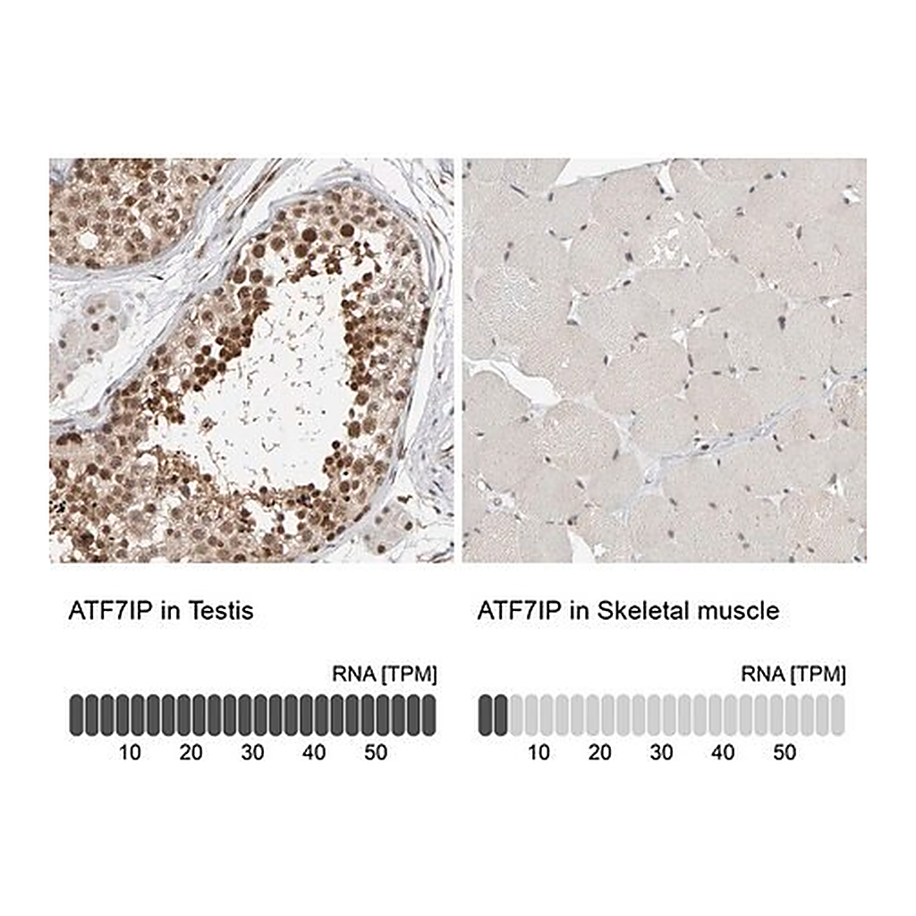 Merck Anti-ATF7IP antibody produced in rabbit