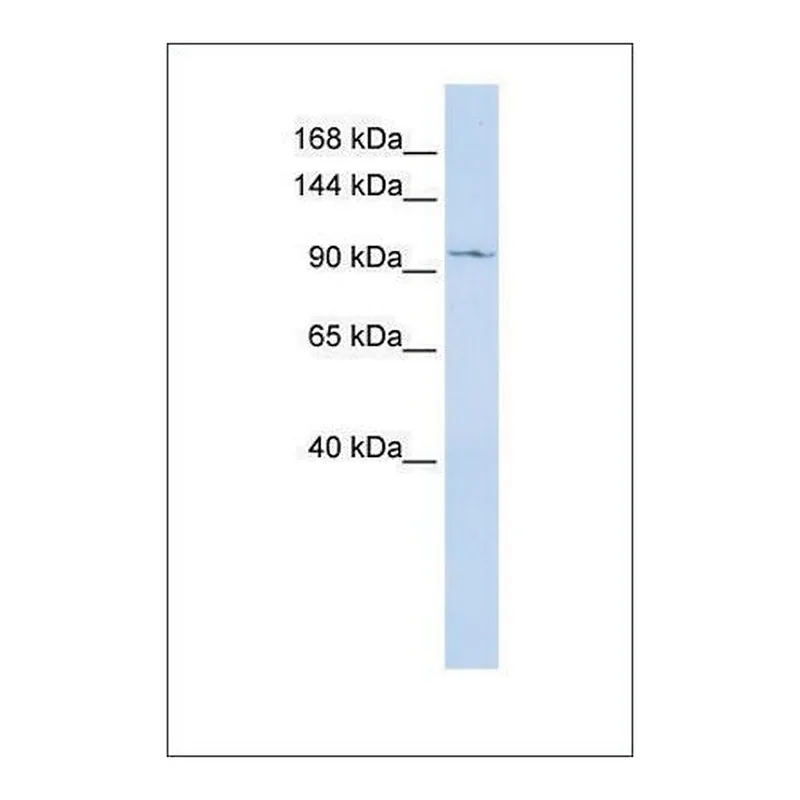 Merck Anti-TRPC6 antibody produced in rabbit