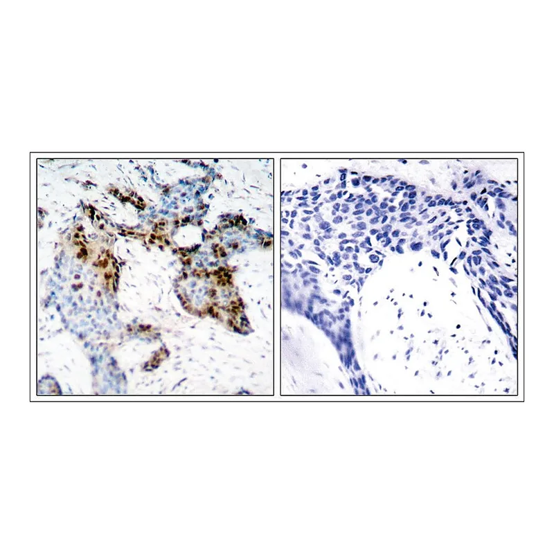 Merck Anti-ESR1 (Ab-118) antibody produced in rabbit