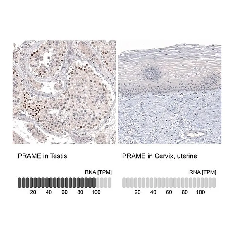 Merck Monoclonal Anti-PRAME antibody produced in mouse