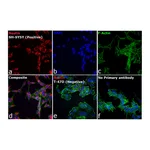 Thermo Fisher Scientific Donkey anti-Mouse IgG (H+L) Secondary Antibody, Qdot 625