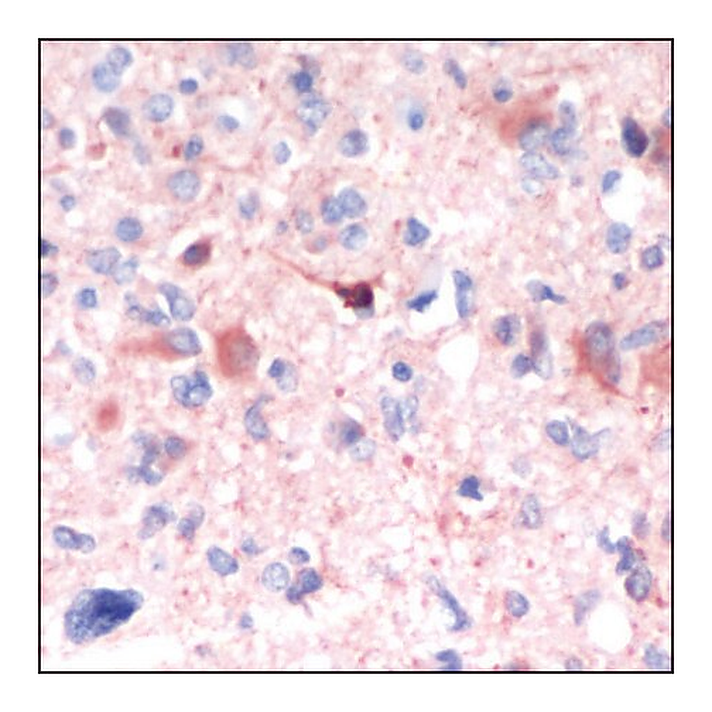 Merck Anti-GFAP antibody, Rabbit monoclonal