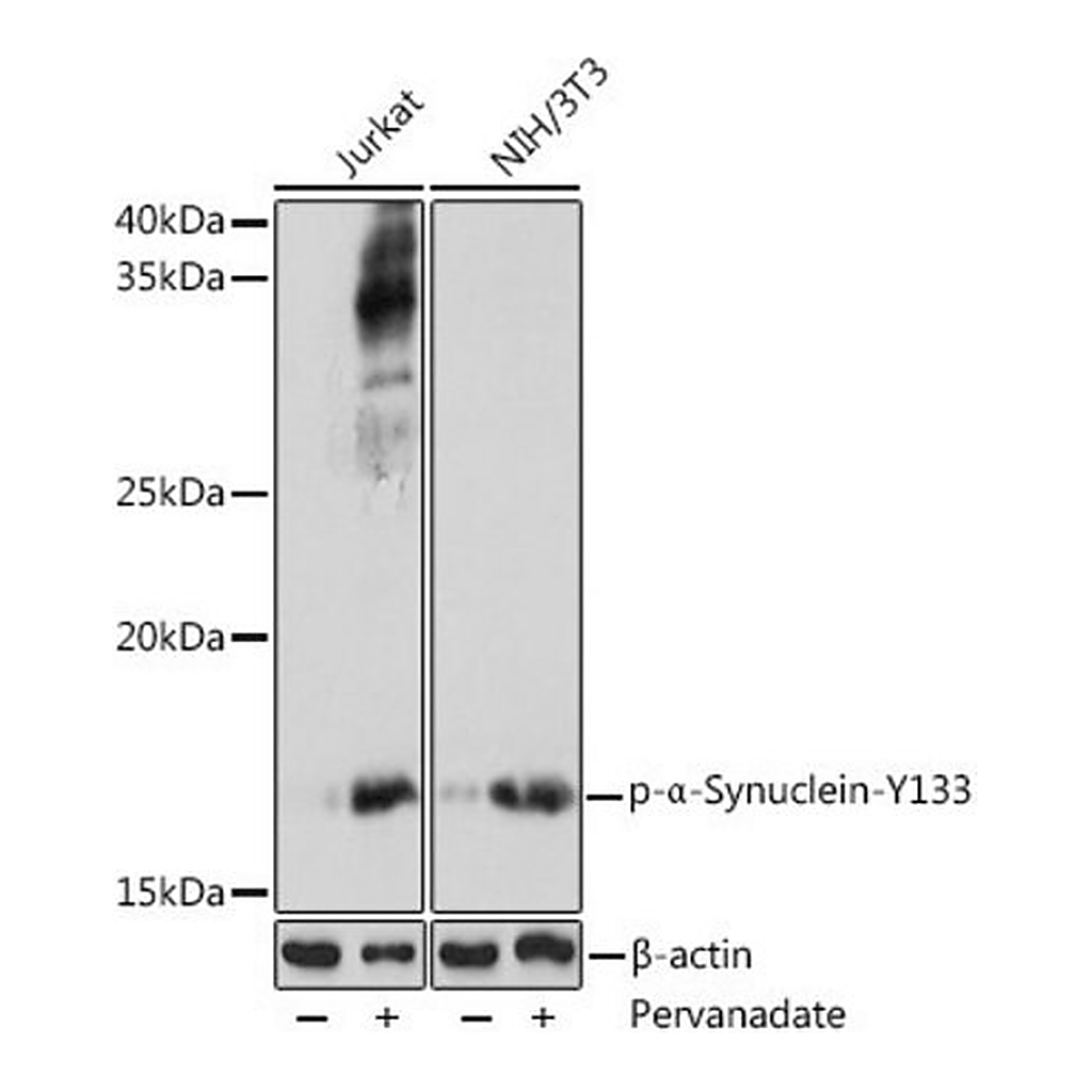 Merck Anti-Phospho-alpha-Synuclein-Y133 antibody produced in rabbit