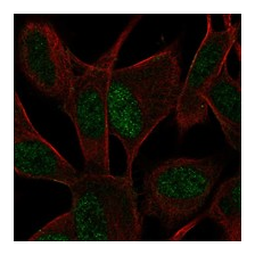 Atlas Antibodies Anti-ASCL1 Antibody