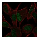 Atlas Antibodies Anti-ASCL1 Antibody