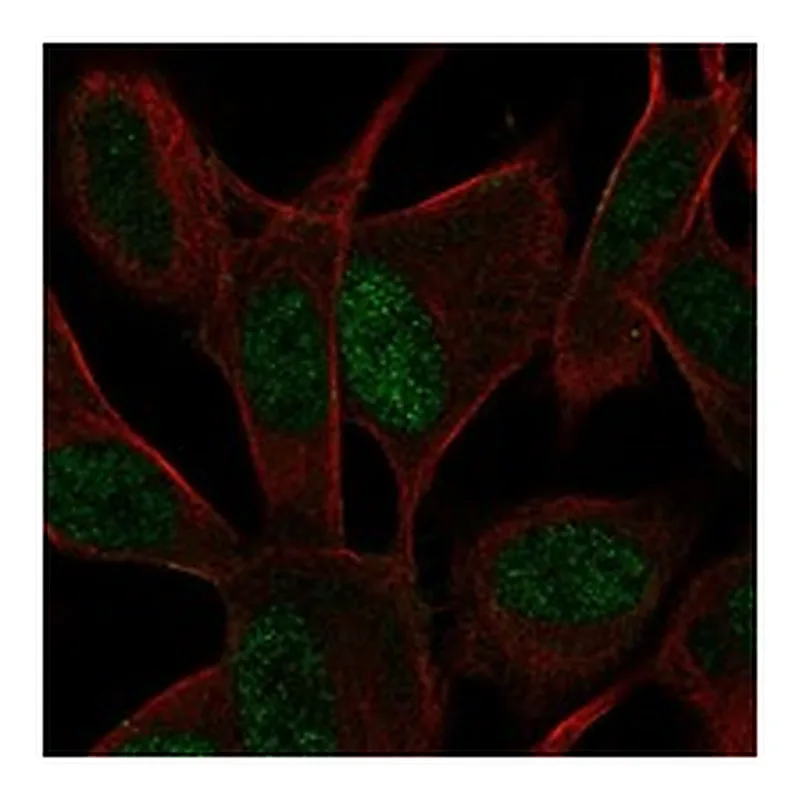 Atlas Antibodies Anti-ASCL1 Antibody