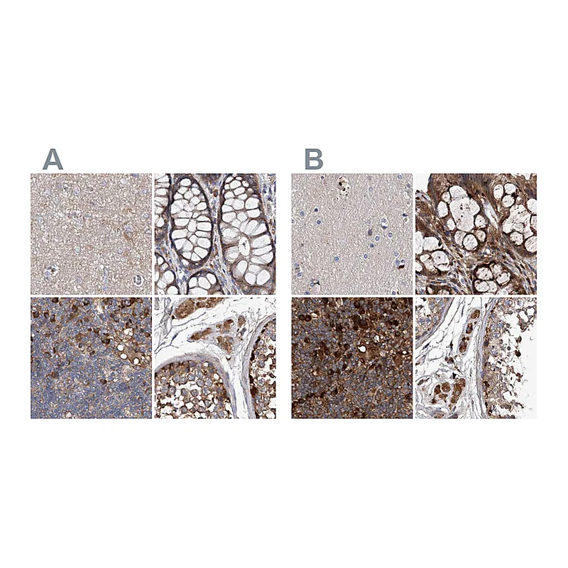 Atlas Antibodies Anti-ASCC3 Antibody