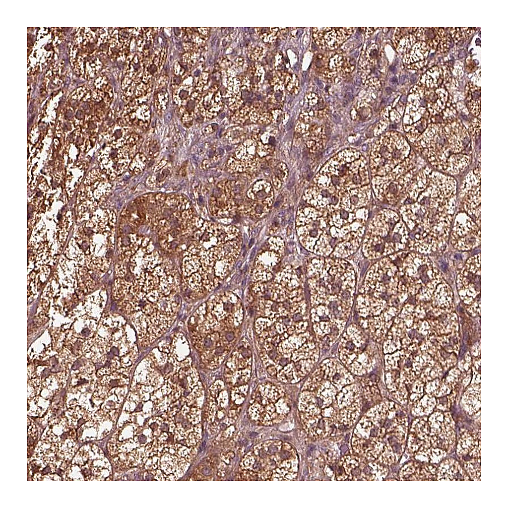 Atlas Antibodies Anti-ASCC2 Antibody
