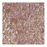 Atlas Antibodies Anti-ASCC2 Antibody