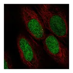 Atlas Antibodies Anti-ASF1A Antibody